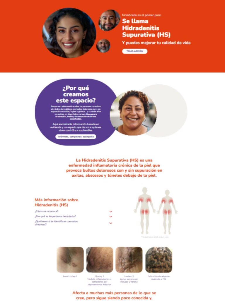 Se llama Hs Hidradenitis Supurativa